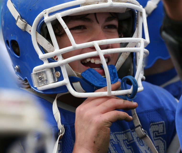 Danger of Concussions in High School Athletes